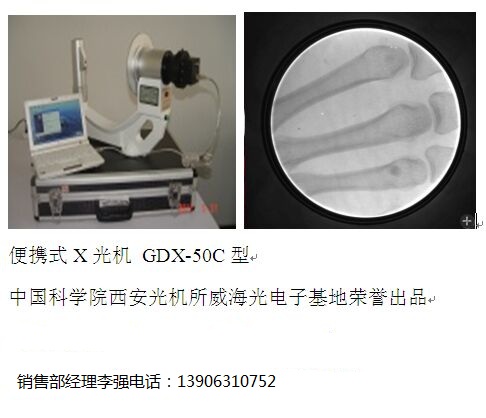 低剂量便携式X光机 低剂量手提式X光机图片