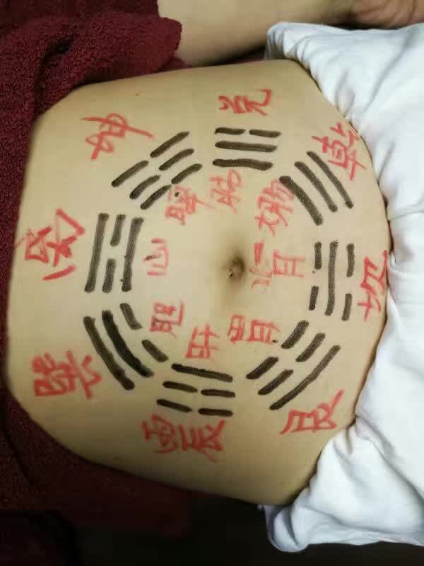 小兒推拿圖片/小兒推拿樣板圖 (4)