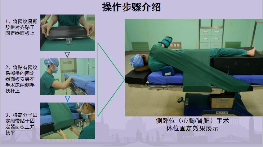 固德易體位固定裝置招商加盟電話(huà)圖片/固德易體位固定裝置招商加盟電話(huà)樣板圖 (2)