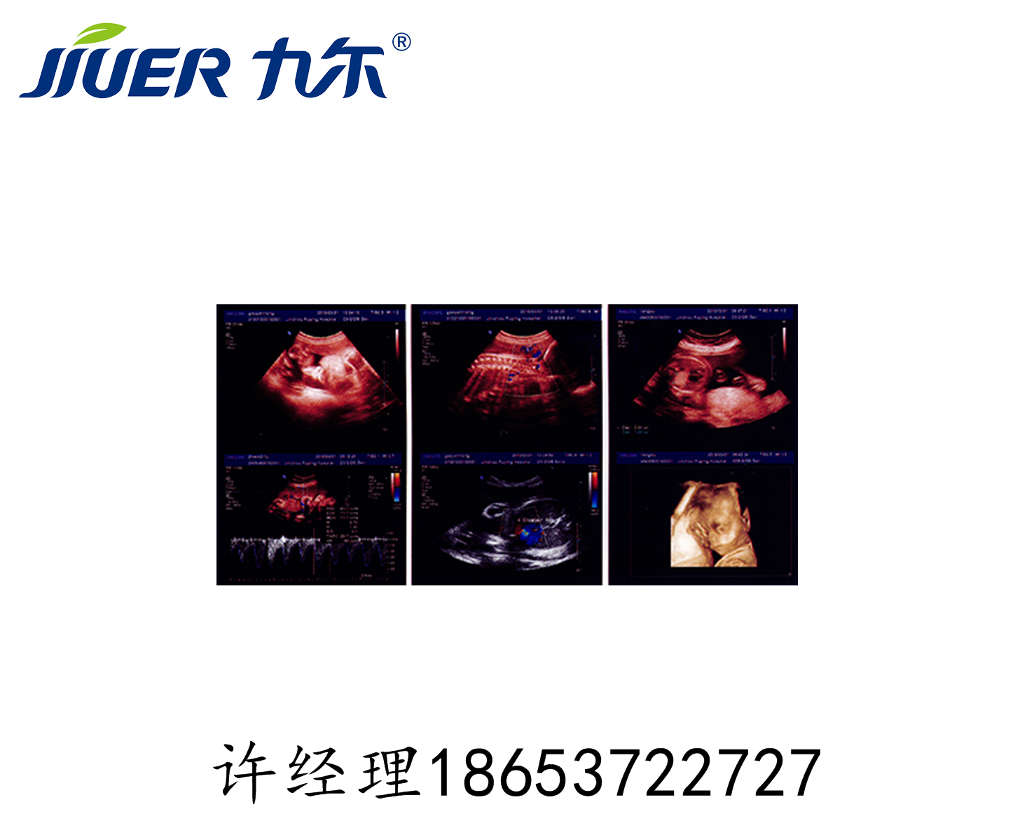 X光膠片圖片/X光膠片樣板圖 (2)