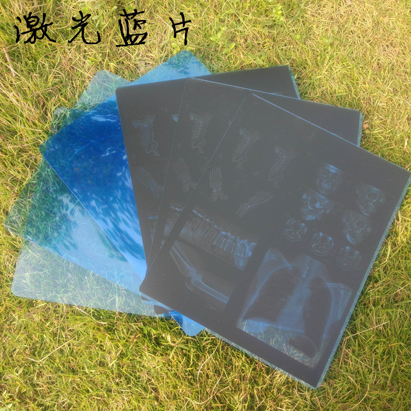 廠家直銷優(yōu)質(zhì)高清環(huán)保放射科*激光藍(lán)片