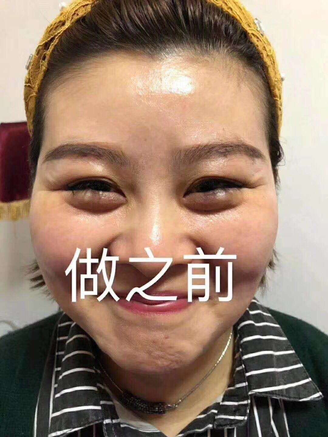 潍坊市薇琴细胞美疗·去皱抗衰厂家