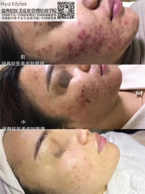 瑞典NK中國總部_瑞典NK輕醫(yī)美皮膚管理培訓加盟模式瑞典輕醫(yī)美*運營中國總部