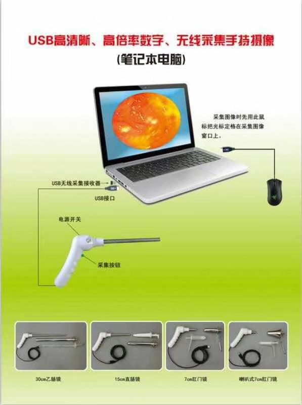 肛腸*機(jī)全套配件供應(yīng)商，德州肛腸*機(jī)全套配件供應(yīng)商，江蘇肛腸*機(jī)全套配件供應(yīng)商