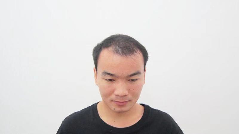 鳳岡假發(fā)織發(fā)圖片/鳳岡假發(fā)織發(fā)樣板圖 (4)