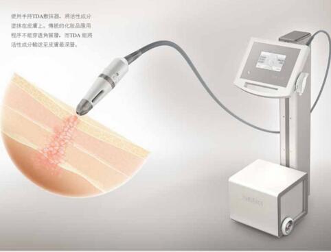 德國SEYO無創(chuàng)無針?biāo)鈨x器圖片/德國SEYO無創(chuàng)無針?biāo)鈨x器樣板圖 (3)