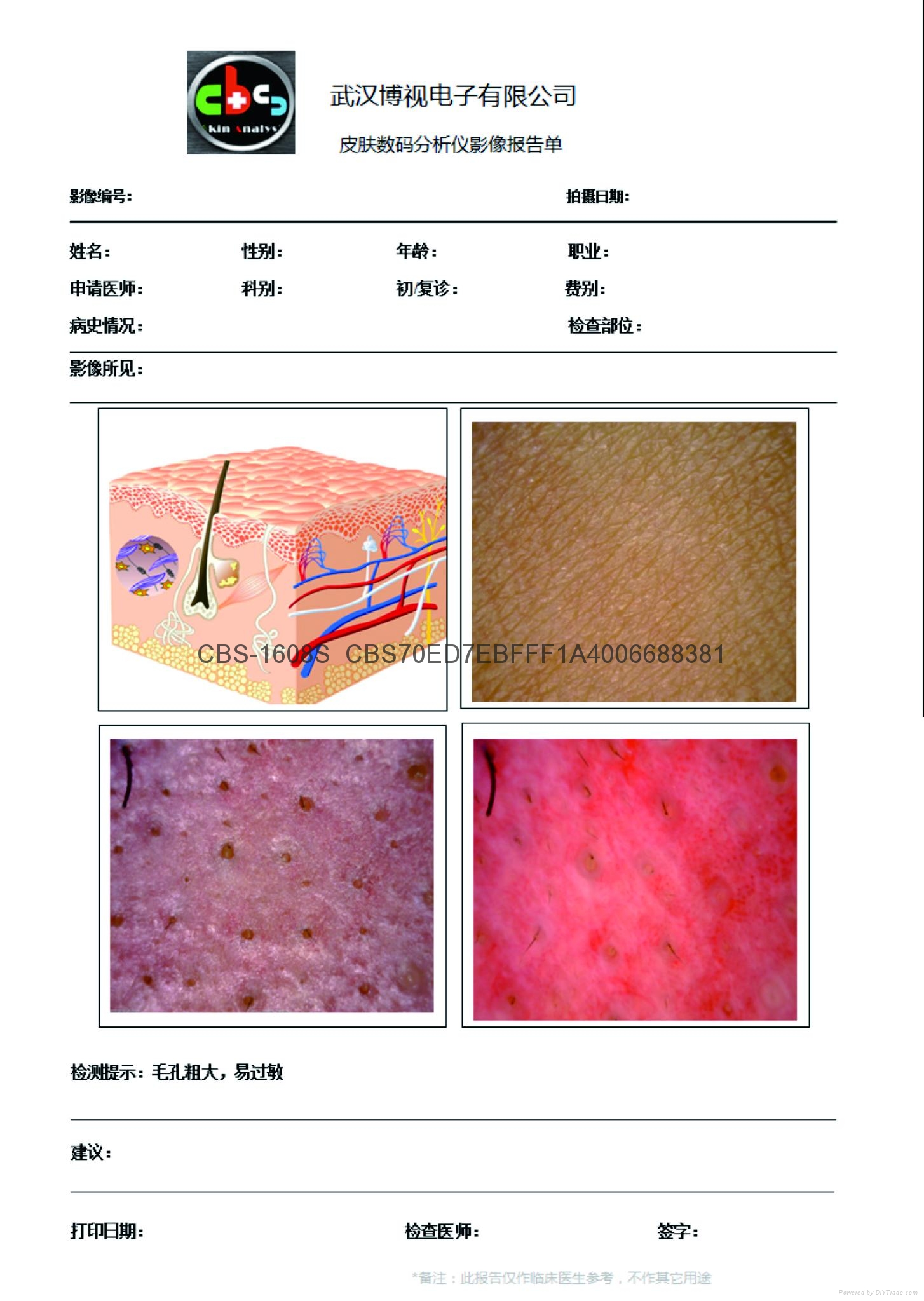 供應(yīng)CBS專(zhuān)業(yè)品牌皮膚檢測(cè)儀/皮膚分析儀/皮膚測(cè)試儀