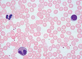 奧林巴斯系統(tǒng)顯微鏡SZX7    奧林巴斯體視顯微鏡SZX7