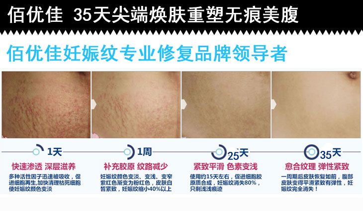 佰優(yōu)佳快速*妊娠紋