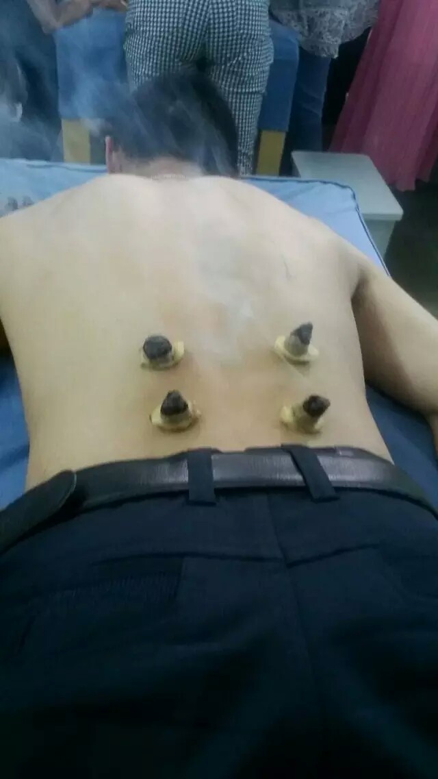 湖南養(yǎng)生理療培訓(xùn)班 湖南推拿培訓(xùn)班 湖南拔罐刮痧培訓(xùn)學(xué)校