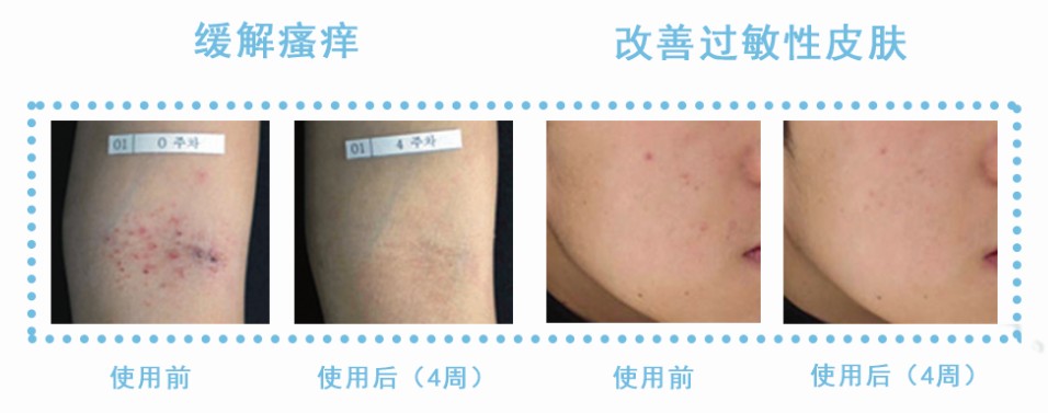 微氣泡護(hù)膚 微氣泡水護(hù)膚
