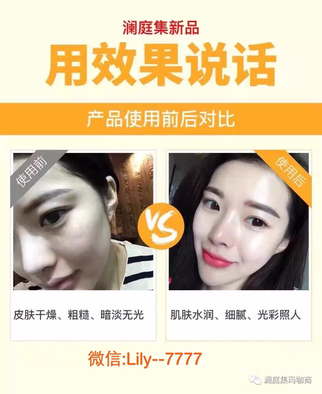 縱美水光霜官網(wǎng)、縱美水光霜總代理