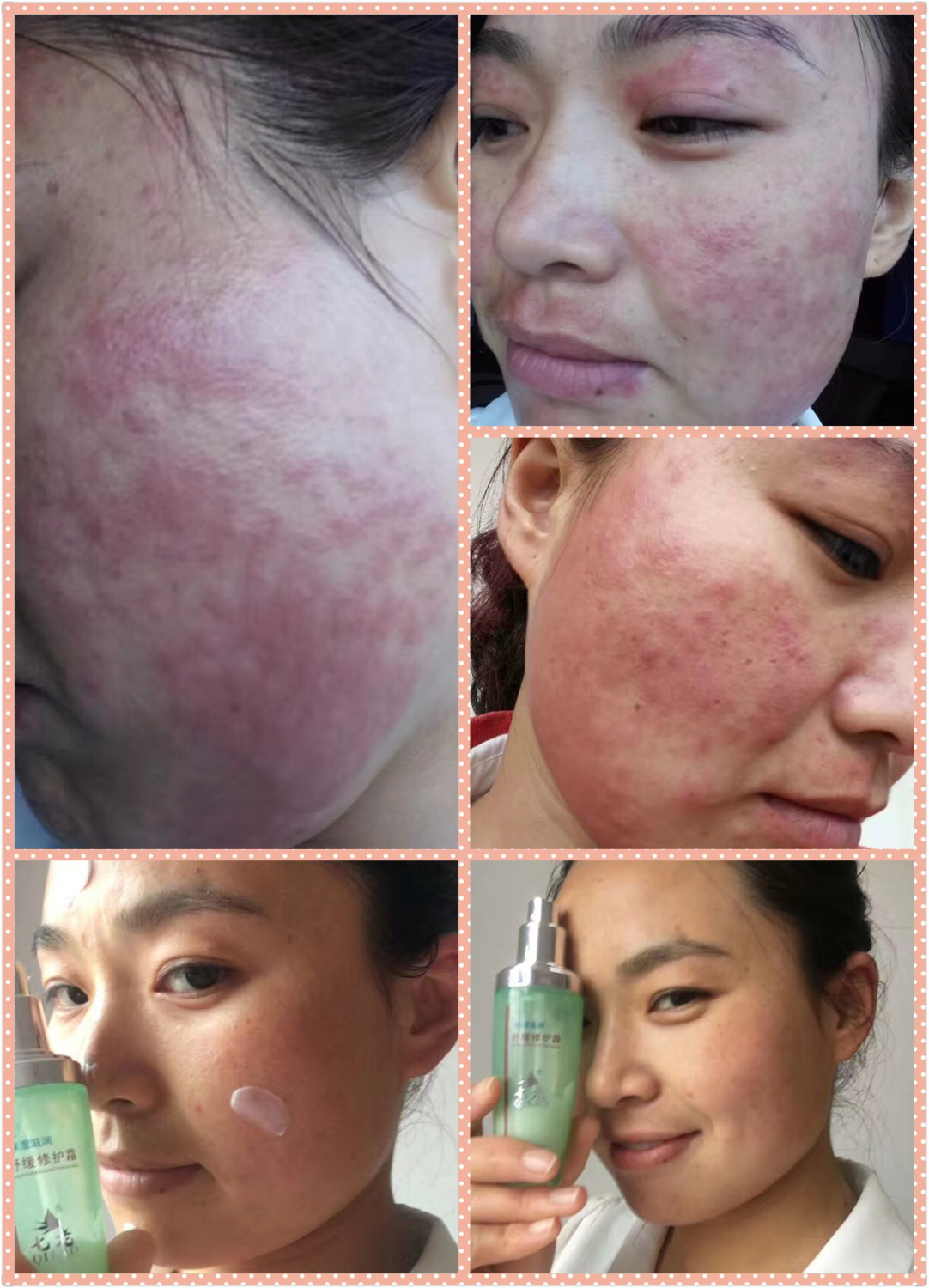 七老護膚官方網(wǎng)站 七老*實體店總經(jīng)銷 七老燕子團隊全國招募七老代理   七老招代理