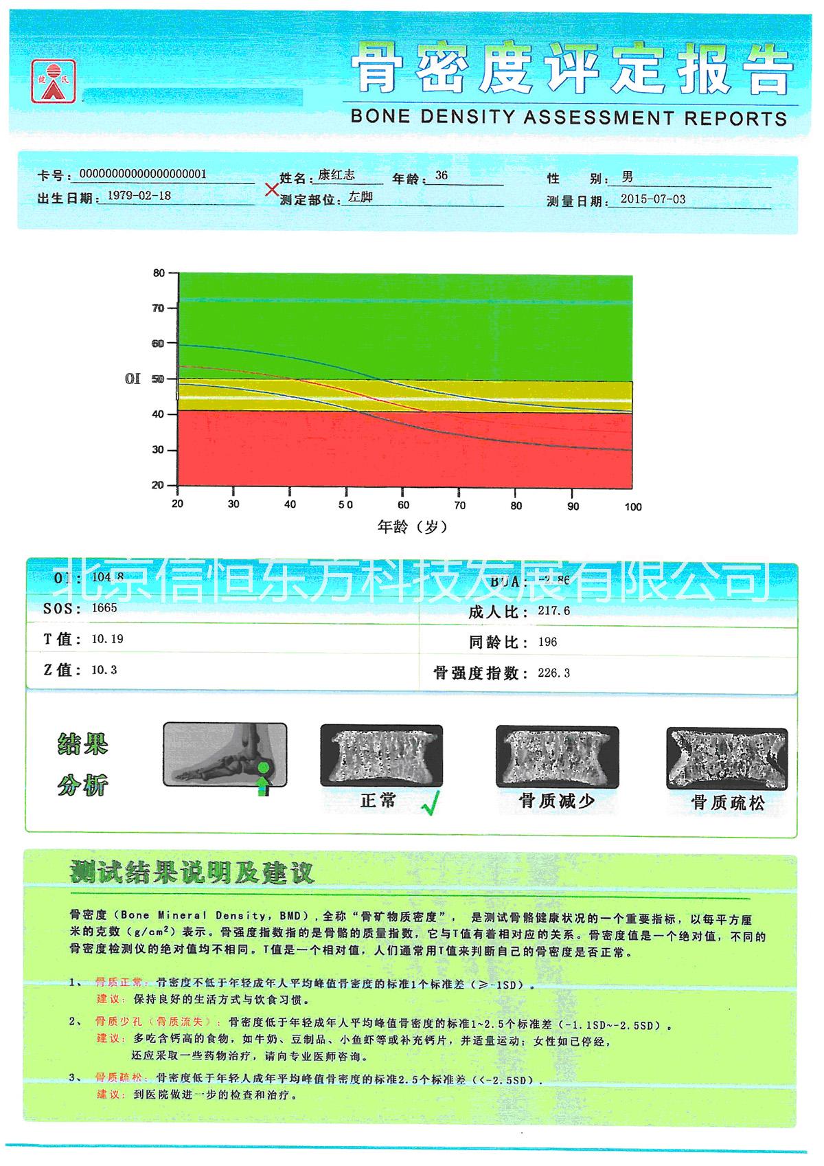 北京骨密度測試儀批發(fā)、現(xiàn)貨、經(jīng)銷商、供應(yīng)【北京信恒東方科技發(fā)展有限公司】
