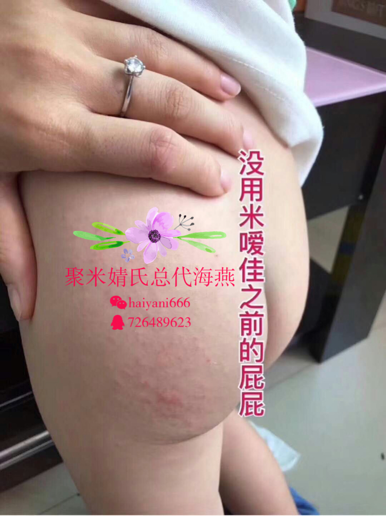 聚米米噯佳紙尿褲尿不濕艾草精華紙尿褲