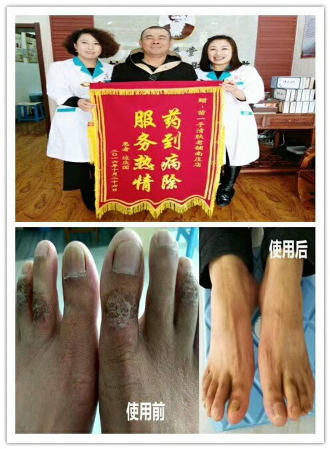 春節(jié)后皮膚病高發(fā)，怎么正確應(yīng)對？ 苗一手清膚老鋪濕露清