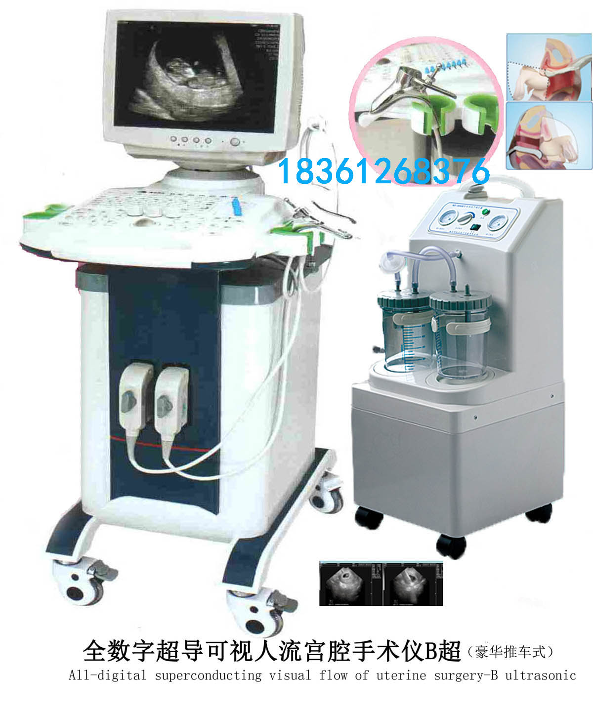 全數(shù)字B型超聲診斷儀黑白B型超機(jī)