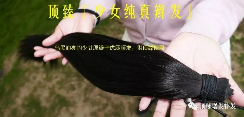 增發(fā)補(bǔ)發(fā)增發(fā)補(bǔ)發(fā)多少錢(qián)？國(guó)際頂臻美學(xué)補(bǔ)發(fā)多少錢(qián)？看脫發(fā)面積和脫發(fā)程度多少錢(qián)？