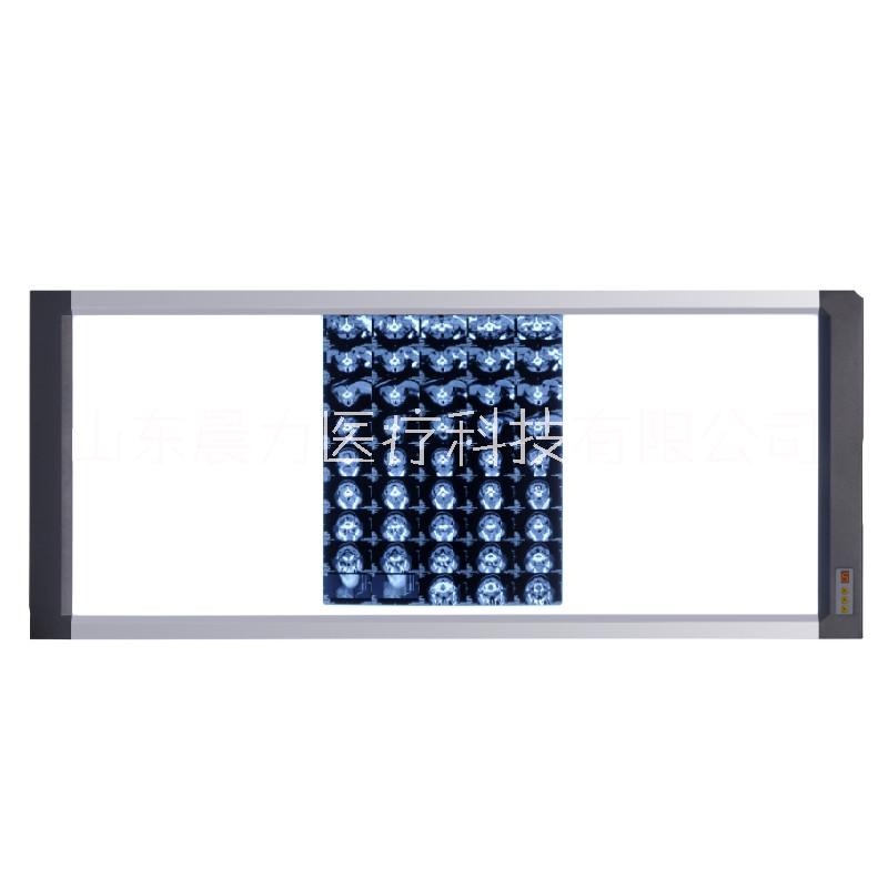 醫(yī)用LED一聯(lián)二聯(lián)三聯(lián)四聯(lián)觀片燈，方便觀看兩到三張片子