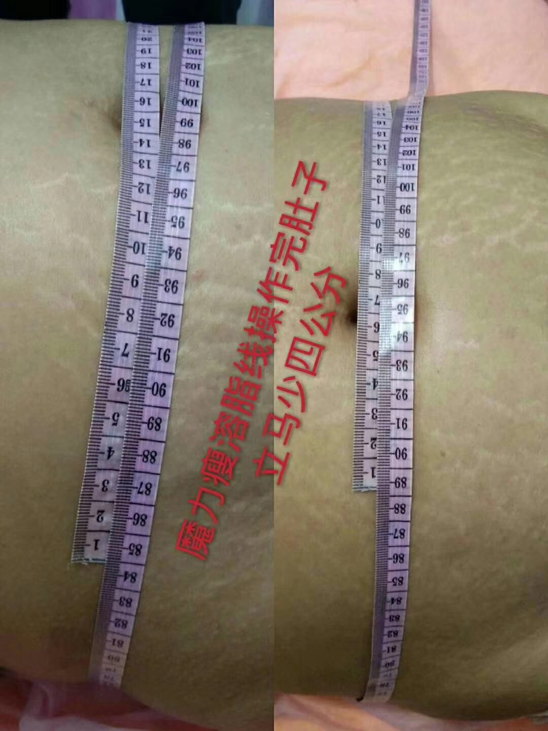 美利貞 *線 * 纖體  美利貞*線 * 纖體