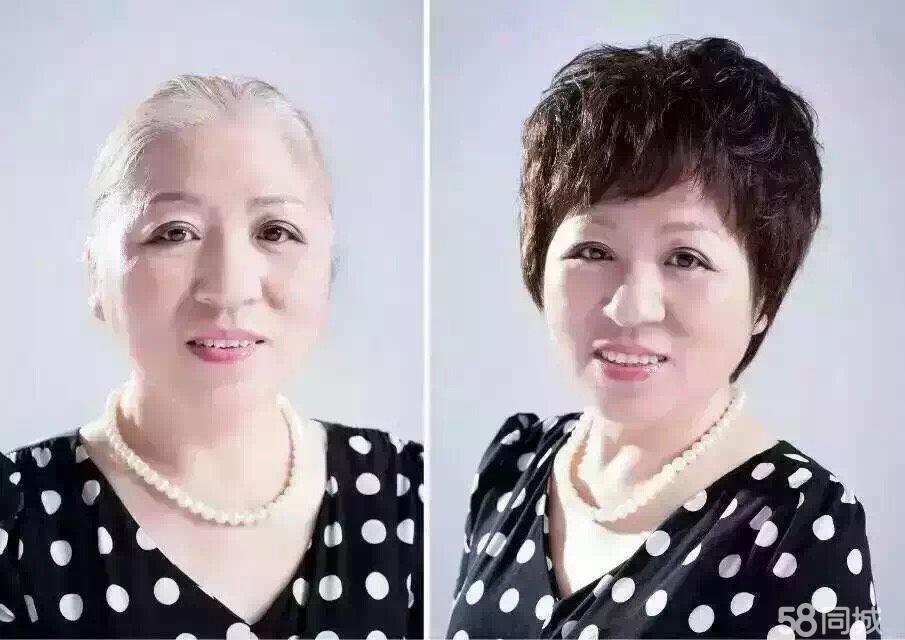 南陽脫發(fā)補(bǔ)發(fā) 假發(fā)定制 脫發(fā)再生
