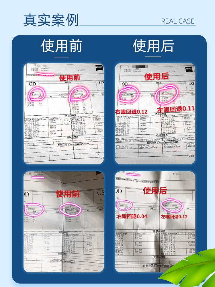 看得清多功能哺光儀 650紅光 朗伯發(fā)光體 貝茨訓(xùn)練 近視防控